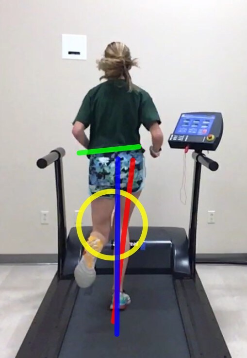 Isabelle Pro undergoes a gait analysis following training with the RunStrong team