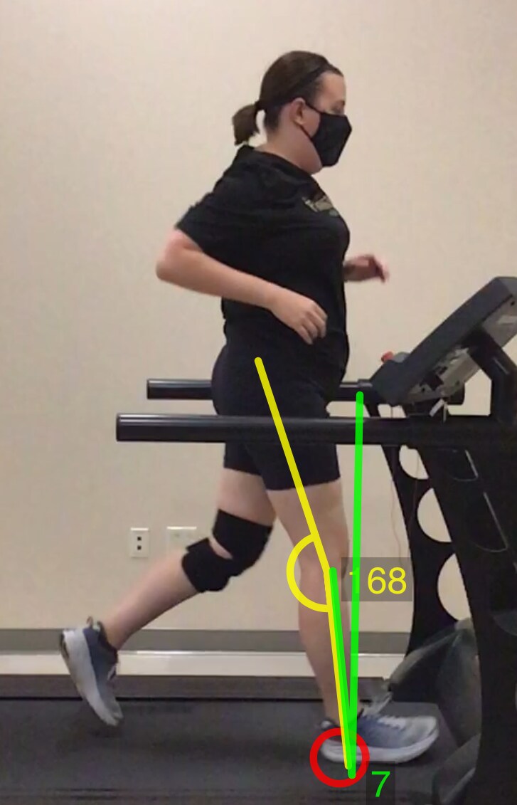 Image of Autumn Bishop demonstrating decreased knee flexion