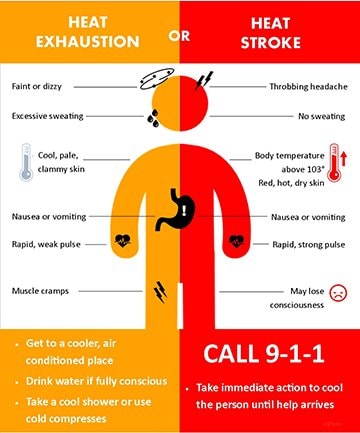 Heat exhaustion or heat stroke image